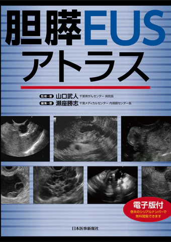 胆膵EUSアトラス イメージ
